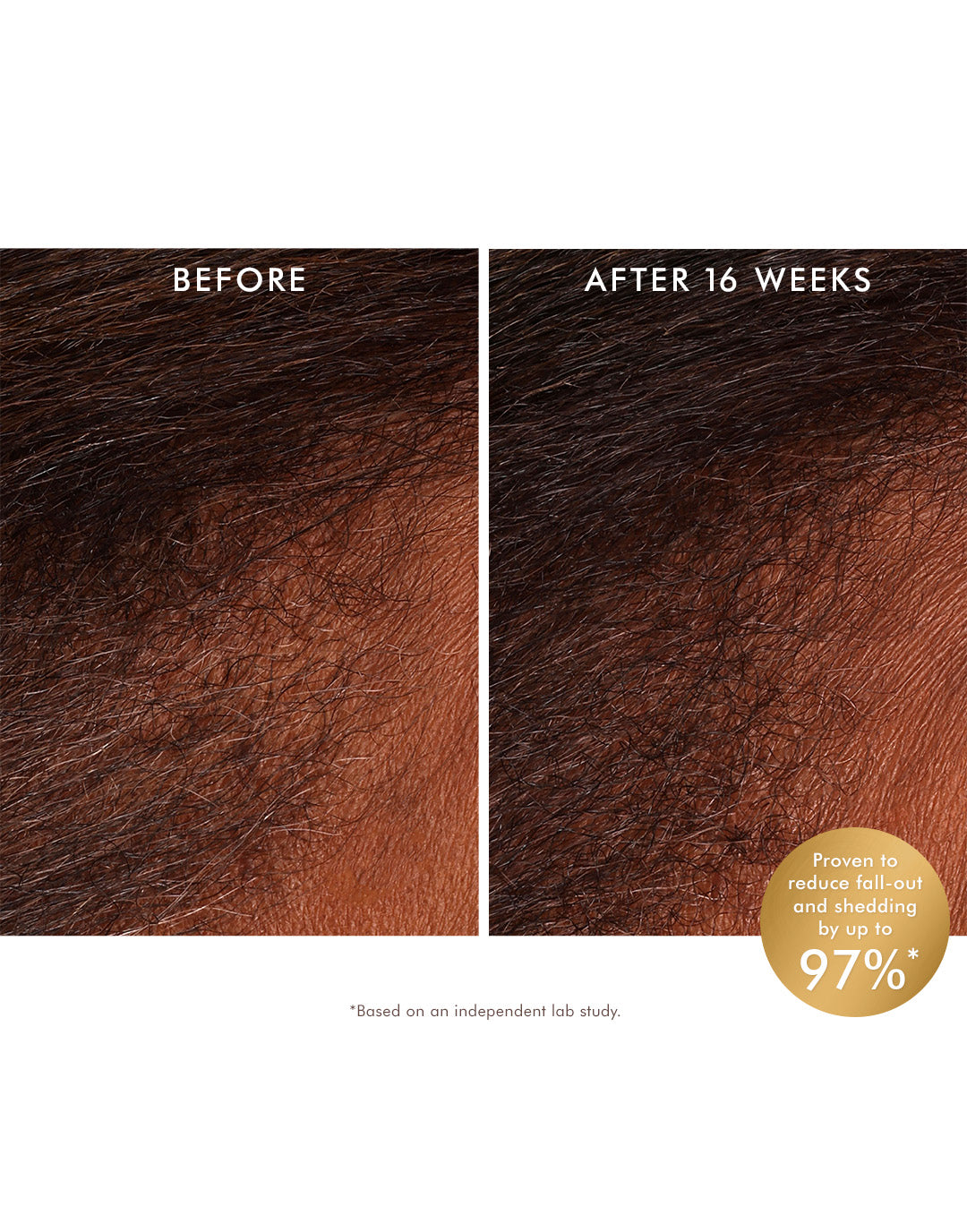 Revitalizing Scalp Tonic for Thicker Hair